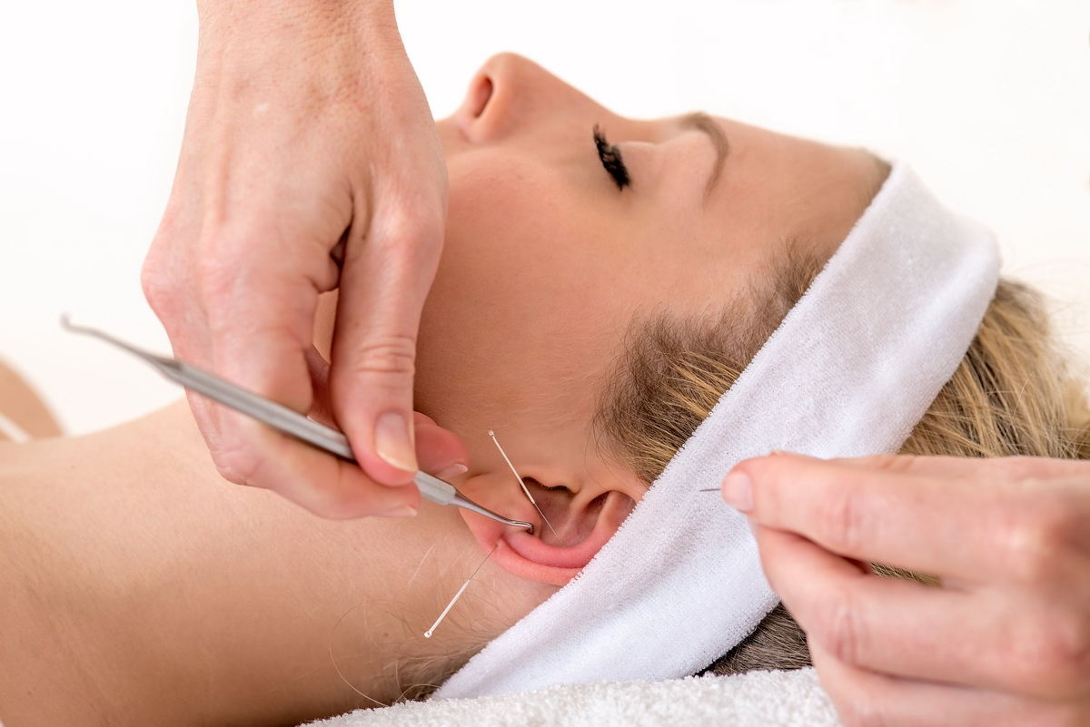 Acupuncture pour le visage